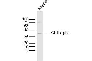 Human HepG2 cells probed with CK II alpha Polyclonal Antibody, unconjugated  at 1:300 overnight at 4°C followed by a conjugated secondary antibody at 1:10000 for 90 minutes at 37°C. (CSNK2A1/CK II alpha Antikörper  (AA 201-300))