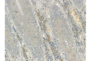 ABIN6256293 and ABIN6267140 at 1/100 staining human normal colon tissue by IHC-P. (MSK1 Antikörper  (pSer360))