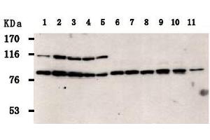 Western Blotting (WB) image for anti-PRP3 Pre-mRNA Processing Factor 3 Homolog (PRPF3) antibody (ABIN1449201)