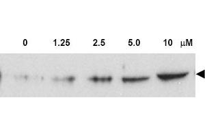 Figure. (CHEK2 Antikörper  (pThr68))