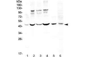 Western blot testing of human 1) HeLa, 2) MCF7, 3) HepG2, 4) A549, 5) rat spleen and 6) mouse thymus lysate with DC-SIGN antibody at 0.