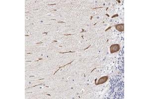 Immunohistochemical staining of human cerebellum with ELFN2 polyclonal antibody  shows strong cytoplasmic positivity in purkinje cells at 1:50-1:200 dilution.