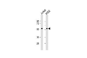 All lanes : Anti-MEF2C Antibody  at 1:1000 dilution Lane 1: Jurkat whole cell lysate Lane 2: K562 whole cell lysate Lysates/proteins at 20 μg per lane. (MEF2C Antikörper  (AA 374-403))
