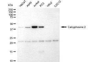 Western blotting analysis using calcyphosine 2 antibody (ABIN7797839).