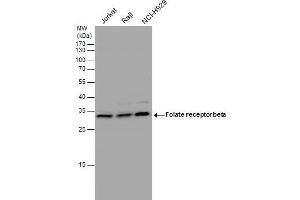 WB Image Folate receptor beta antibody detects Folate receptor beta protein by western blot analysis.