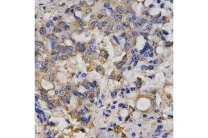 Immunohistochemistry (IHC) image for anti-Chloride Channel 5 (CLCN5) antibody (ABIN1876908) (Chloride Channel 5 Antikörper)