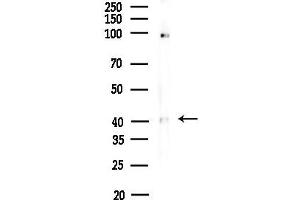 anti-Vasohibin 1 (VASH1) (Internal Region) antibody