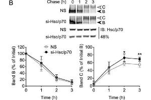 Hsc70/Hsp70 suppresses levels of mature CFTR. (HSP70/HSC70 Antikörper)