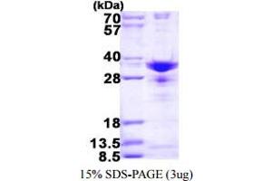 SDS-PAGE (SDS) image for Small Nuclear Ribonucleoprotein Polypeptide A (SNRPA) (AA 1-255) protein (His tag) (ABIN6386877) (SNRPA1 Protein (AA 1-255) (His tag))