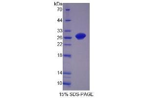 SDS-PAGE (SDS) image for Oligophrenin 1 (OPHN1) (AA 634-802) protein (His tag) (ABIN4989462)