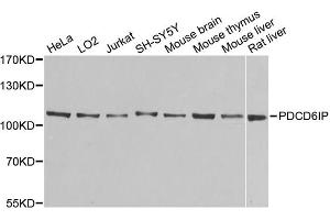Western blot analysis of extracts of various cell lines, using PDCD6IP antibody (ABIN5971240) at 1/1000 dilution.