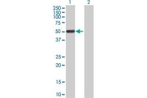 Western Blot analysis of GAL3ST4 expression in transfected 293T cell line by GAL3ST4 MaxPab polyclonal antibody. (GAL3ST4 Antikörper  (AA 1-486))