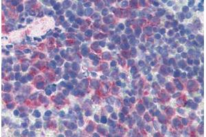 Mouse Spleen: Formalin-Fixed, Paraffin-Embedded (FFPE) (CD69 Antikörper  (FITC))
