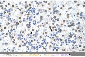 Rabbit Anti-MSI2 Antibody ,Paraffin Embedded Tissue: Human Liver  Cellular Data: Hepatocytes  Antibody Concentration: 4. (MSI2 Antikörper  (N-Term))