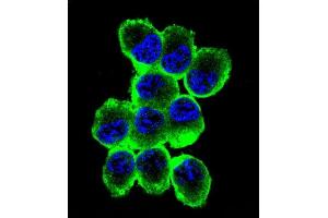 Confocal immunofluorescent analysis of MBP Antibody (Ascites) ABIN1539854 with NCI- cell followed by Alexa Fluor® 488-conjugated goat anti-mouse lgG (green). (MBP Antikörper)