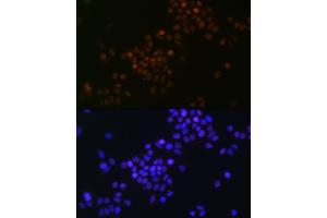 Immunofluorescence (IF) image for anti-Myc Proto-Oncogene protein (MYC) antibody (ABIN7268711)