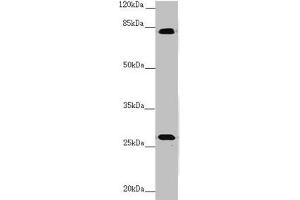 Western blot All lanes: MID2 antibody at 3. (Midline 2 Antikörper  (AA 506-735))
