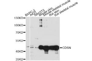 Western blot analysis of extracts of various cell lines, using CDSN antibody (ABIN6294198) at 1:1000 dilution. (Corneodesmosin Antikörper)