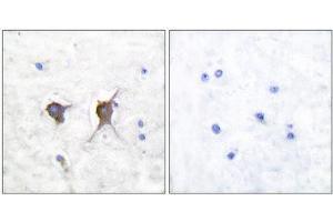 Immunohistochemistry (IHC) image for anti-BCL2-Associated X Protein (BAX) (N-Term) antibody (ABIN1848438) (BAX Antikörper  (N-Term))