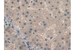 Immunohistochemistry (IHC) image for anti-Retinol Binding Protein 5, Cellular (RBP5) (AA 2-135) antibody (ABIN7439078)