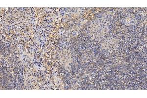 Immunohistochemistry (IHC) image for anti-Matrix Metallopeptidase 8 (Neutrophil Collagenase) (MMP8) (AA 101-467) antibody (ABIN7425689)