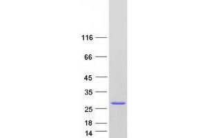 Western Blotting (WB) image for Ropporin, Rhophilin Associated Protein 1B (ROPN1B) protein (Myc-DYKDDDDK Tag) (ABIN2731070)