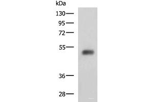 Western blot analysis of Human bladder transitional cell carcinoma grade 2-3 tissue lysate using SLC30A6 Polyclonal Antibody at dilution of 1:2000