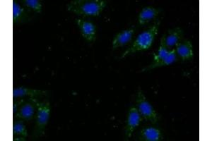 Detection of CDNF in Human U2OS Cells using Monoclonal Antibody to Cerebral Dopamine Neurotrophic Factor (CDNF) (CDNF Antikörper  (AA 33-187))