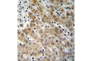 Formalin fixed and paraffin embedded human liver tissue reacted with Endothelin-1 Antibody (C-term) followed by peroxidase conjugation of the secondary antibody and DAB staining. (Endothelin 1 Antikörper  (C-Term))