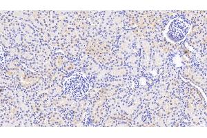 Detection of PTPN13 in Human Kidney Tissue using Polyclonal Antibody to Protein Tyrosine Phosphatase, Non Receptor Type 13 (PTPN13) (PTPN13 Antikörper  (AA 1-161))