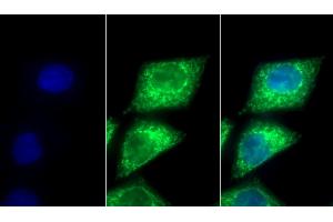 Detection of PDHA1 in Human HepG2 cell using Polyclonal Antibody to Pyruvate dehydrogenase alpha 1 (PDHA1) (PDHA1 Antikörper  (AA 30-390))