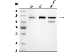 Western blot analysis of Daxx using anti-Daxx antibody (ABIN3043822). (DAXX Antikörper  (AA 56-345))