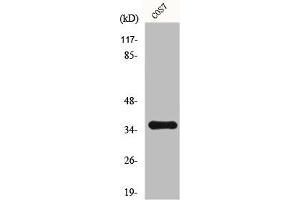 Western Blot analysis of 293 cells using Fos B Polyclonal Antibody (FOSB Antikörper)