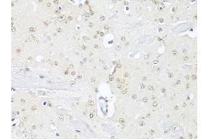 Immunohistochemistry of paraffin-embedded mouse brain using RBFOX3 antibody (ABIN1874561) at dilution of 1:100 (40x lens). (NeuN Antikörper)