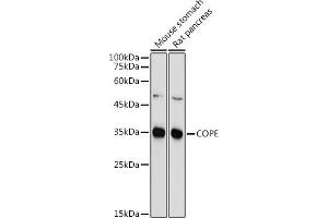 Western blot analysis of extracts of various cell lines, using COPE antibody (ABIN6133492, ABIN6138873, ABIN6138874 and ABIN6214159) at 1:1000 dilution. (COPE Antikörper  (AA 1-308))