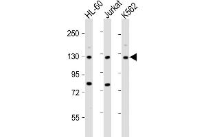 All lanes : Anti-ATP2A3 Antibody (N-Term) at 1:2000 dilution Lane 1: HL-60 whole cell lysate Lane 2: Jurkat whole cell lysate Lane 3: K562 whole cell lysate Lysates/proteins at 20 μg per lane. (ATP2A3 Antikörper  (AA 13-47))