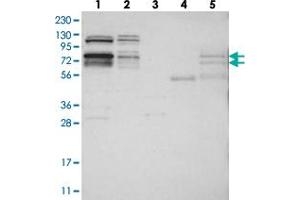 Western blot analysis of Lane 1: RT-4, Lane 2: U-251 MG, Lane 3: Human Plasma, Lane 4: Liver, Lane 5: Tonsil with RBM28 polyclonal antibody  at 1:250-1:500 dilution. (RBM28 Antikörper)