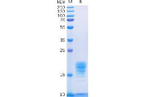 SDS-PAGE (SDS) image for Interleukin 5 (IL5) (AA 20-134) protein (His tag) (ABIN6961138)