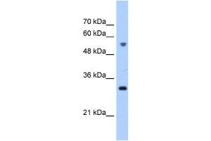 TTC5 antibody used at 0. (TTC5 Antikörper  (C-Term))