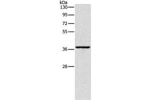 Western Blot analysis of Huvec cell using APOL2 Polyclonal Antibody at dilution of 1:375 (Apolipoprotein L 2 Antikörper)