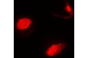 Immunofluorescent analysis of SUFU staining in MCF7 cells.