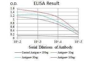 Black line: Control Antigen (100 ng), Purple line: Antigen(10 ng), Blue line: Antigen (50 ng), Red line: Antigen (100 ng), (Cytokeratin 5 Antikörper  (AA 316-590))