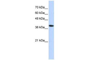 Western Blotting (WB) image for anti-ATPase, H+/K+ Exchanging, beta Polypeptide (ATP4b) (Middle Region) antibody (ABIN635524)
