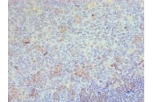 Immunohistochemistry (IHC) image for anti-CD68 Molecule (CD68) (AA 22-319) antibody (ABIN7158900)