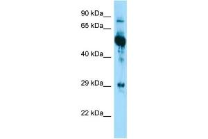 WB Suggested Anti-KRT6A Antibody Titration: 1.