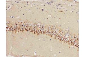 Anti-5HT1A Receptor antibody, IHC(P): Rat Brain Tissue (Serotonin Receptor 1A Antikörper  (C-Term))