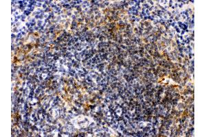 Immunohistochemistry (Paraffin-embedded Sections) (IHC (p)) image for anti-Actin, alpha 1, Skeletal Muscle (ACTA1) (AA 277-308), (C-Term) antibody (ABIN3043519) (Actin Antikörper  (C-Term))