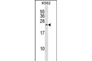 Western Blotting (WB) image for anti-Myosin, Light Chain 6B, Alkali, Smooth Muscle and Non-Muscle (MYL6B) (AA 96-123) antibody (ABIN1538709)