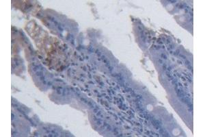 Detection of IL15 in Rat Small intestine Tissue using Monoclonal Antibody to Interleukin 15 (IL15) (IL-15 Antikörper  (AA 49-162))