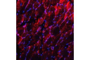 IF analysis of Desmin using anti-Desmin antibody (ABIN3043265).